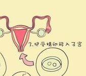 2026年没有卵泡去湛江久和医院做三代试管的攻略介绍，一文了解完整步骤